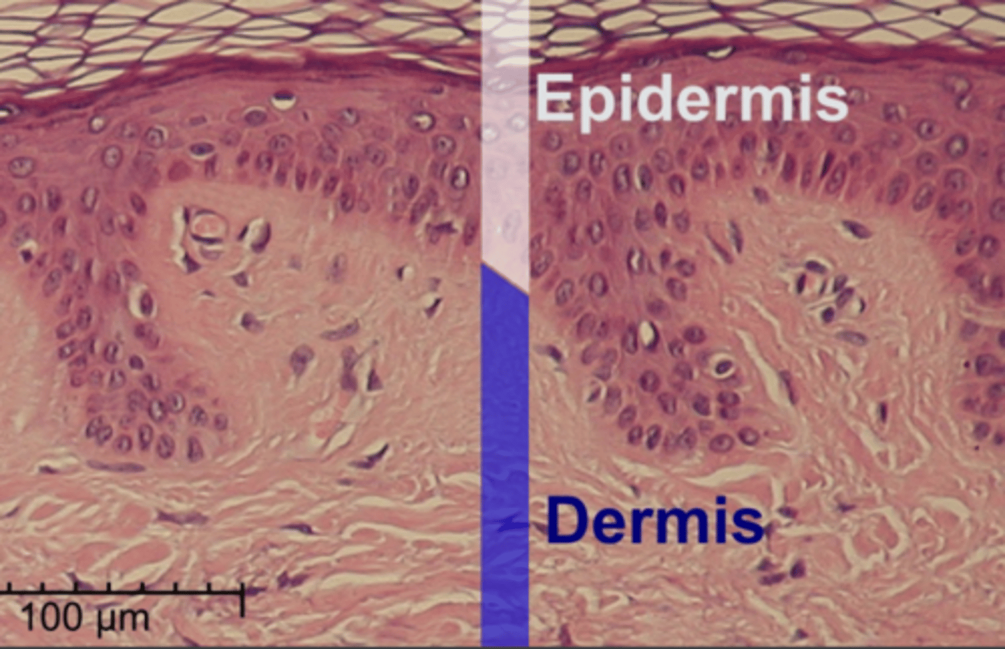 <p>Epidermis</p>