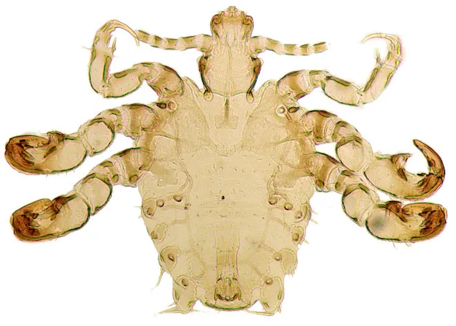 <p>2-4 mm</p>