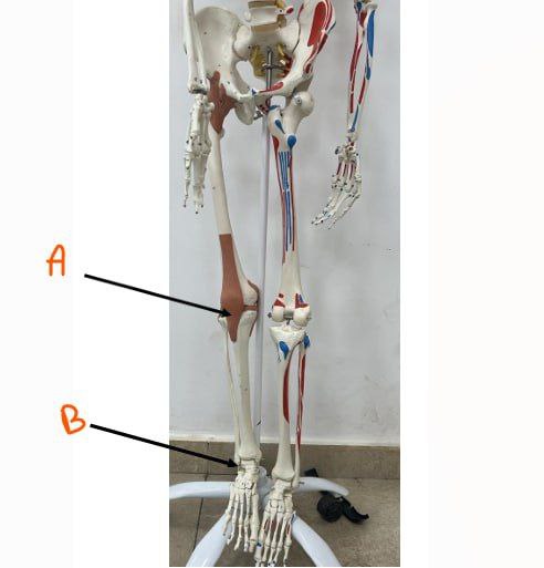 <p>Identify the joints in these picures and classify them</p>