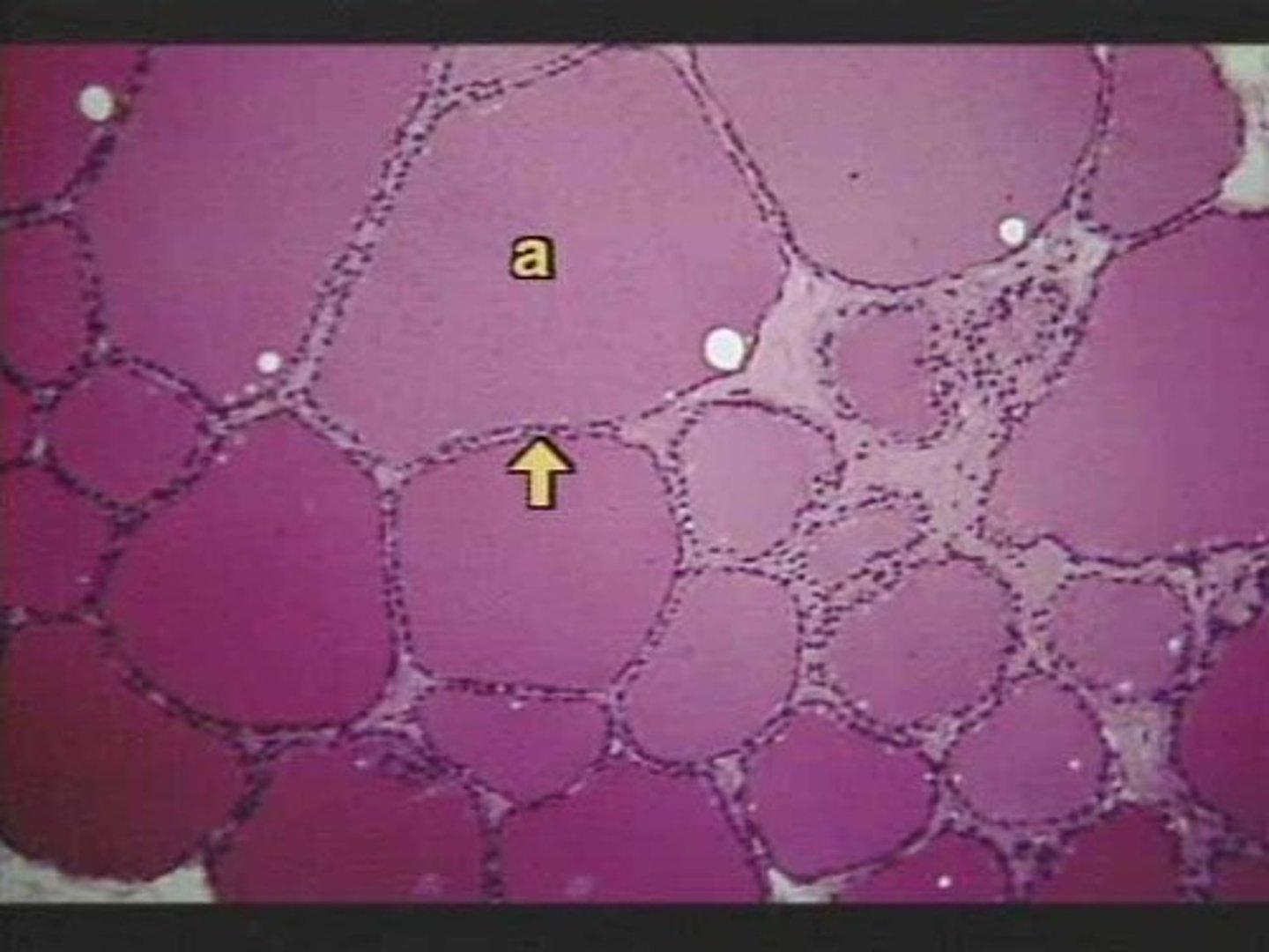 <p>somatic cells that surround the oocyte and support cells during egg development</p>
