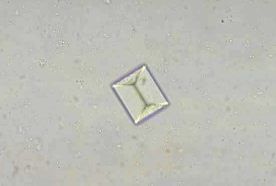 <p>What do you see in this image? Indication?</p>