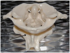 Name the entire bottom bone indicated by the arrow.