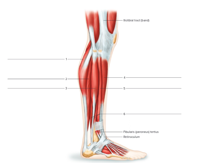 <p>Label the following: Lateral right leg </p>
