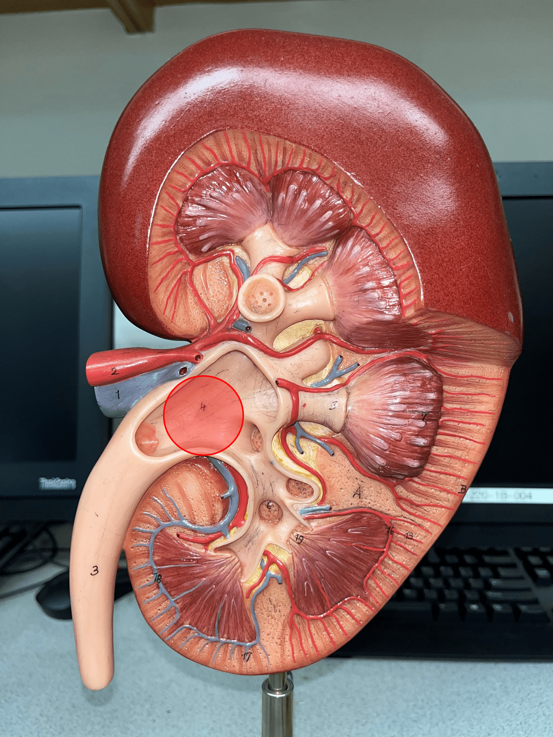 • The innermost region of the internal kidney.

• Collects urine from the major calyces and drains it into the ureters.

• Includes the minor and major calyces.