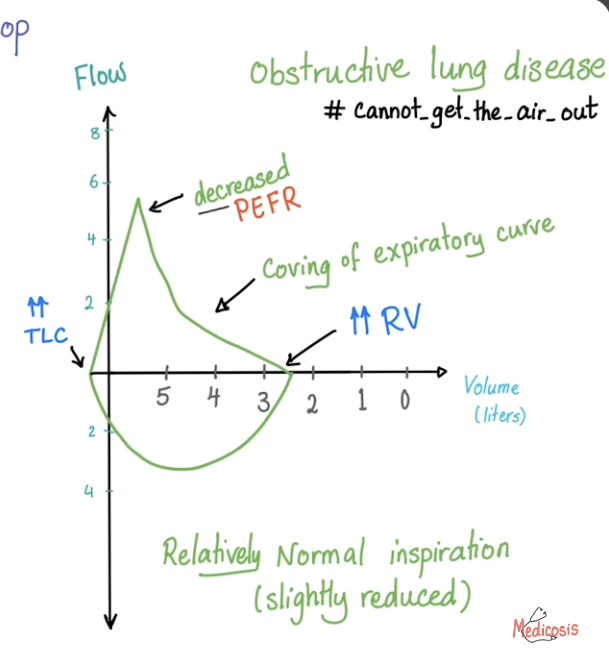 <ul><li><p>Air cannot come out</p></li><li><p>PEFR decreased </p></li><li><p>Coving of expiratory curve</p></li><li><p>Inspiration relatively normal</p></li></ul><p></p>