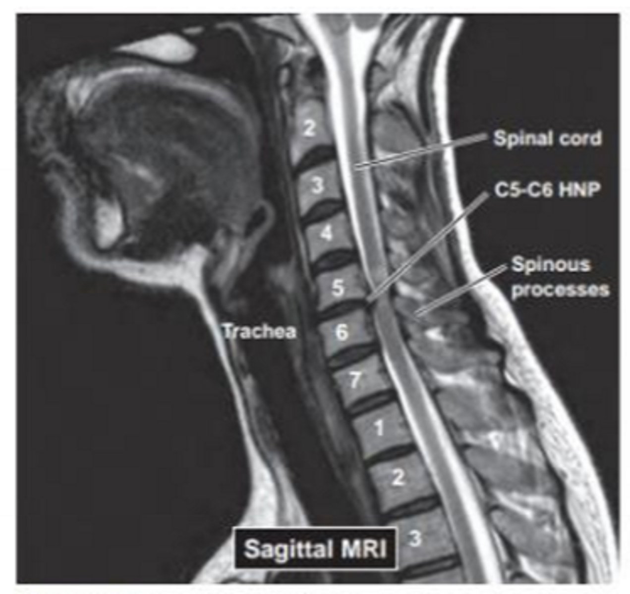 <p>What pathology is this?</p>