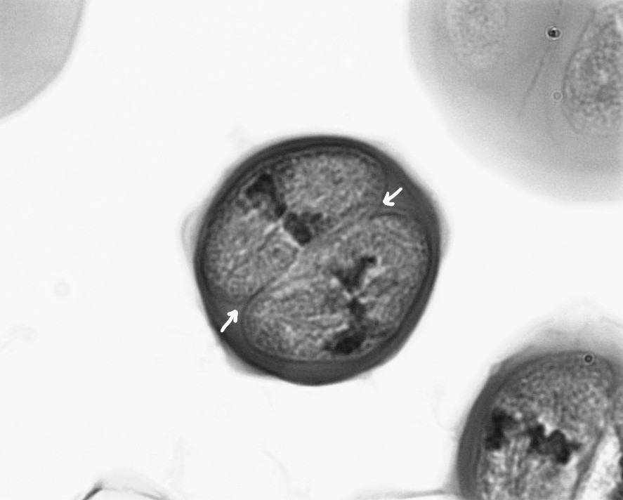 <p>what stage of cell division is this?&nbsp;</p>