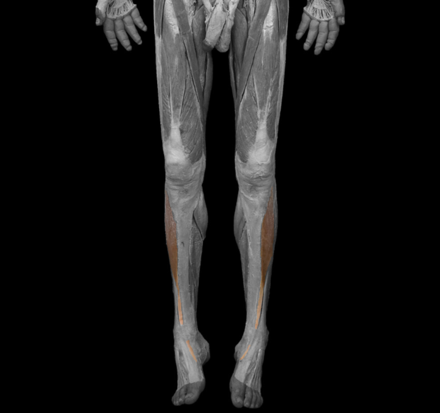 <p>origin: lateral condyle and body of tibia, interosseous membrane </p><p></p><p>insertion: metatarsal I and medial cuneiform </p><p></p><p>action: dorsiflex foot at ankle, supinate foot at inter tarsal </p><p></p><p>innvervation: deep fibular/peroneal nerve </p>