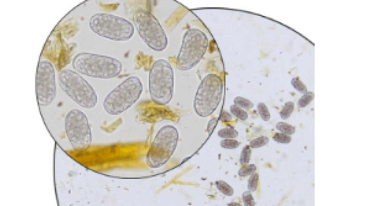 <p>Identify these thin shelled, ellipsoidal, greyish eggs found in large & small ruminants</p>