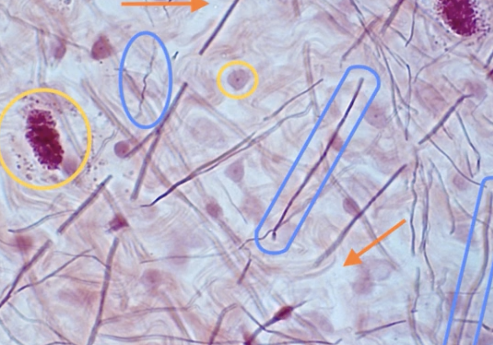 <p>What is circled in blue?</p>