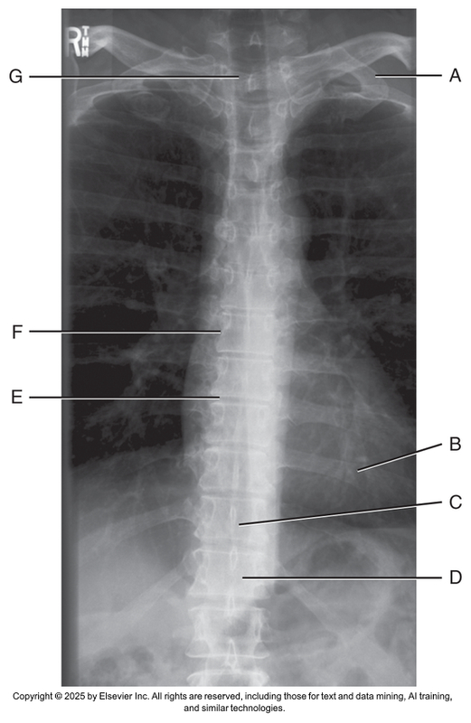 <p>What anatomical structure is letter G?</p>