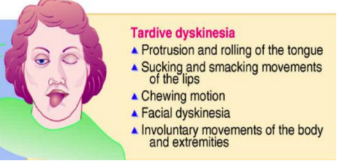 <p>Tardive dykinesia</p>