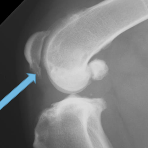 <p>What is the image pointing to? </p>