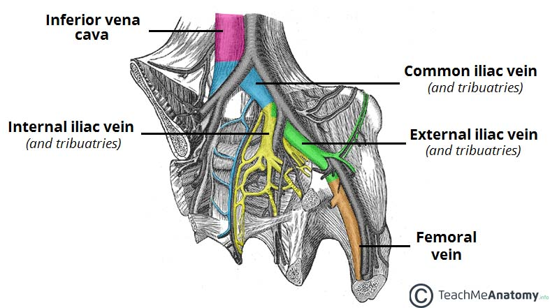 <p>A The external iliac vein lies medial to the external iliac artery</p><p>-external iliac veins join the internal iliac veins to form the common iliac veins, which then merge into the inferior vena cava (B false)</p><p>-inferior vena cava <strong>can be imaged</strong> by CT, ultrasound, and other methods (so C is incorrect)</p><p>-Pelvic veins are typically imaged by <strong>venography</strong>, not arteriograms (D is incorrect).</p>