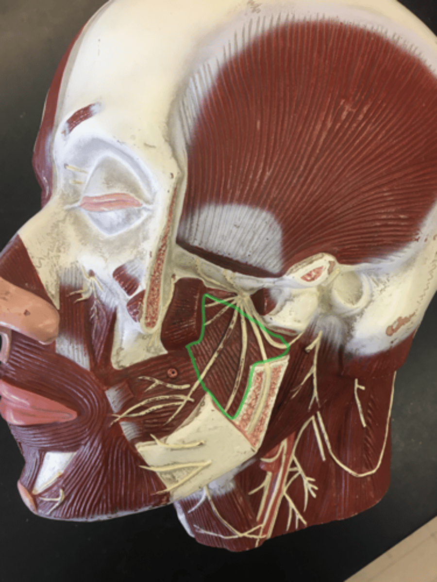 <p>(bottom) vertical striations</p><p>Origin: Pterygoid Process </p><p>Insertion: Ramus of the Mandible</p>
