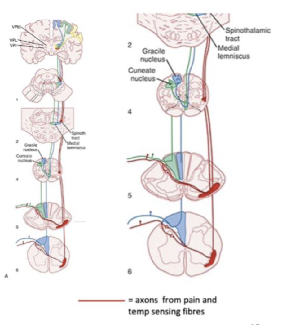 <p>Ascending somatosensory pathway 2 (spinothalamic tract)</p>