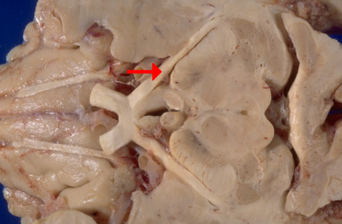 <p>Label this brain structure</p>
