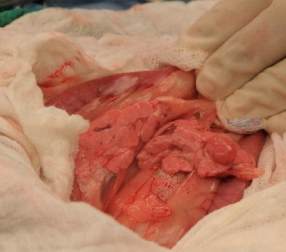 <p>-partial pancreatectomy</p><p>-resect suspected metastatic lesions when possible</p>
