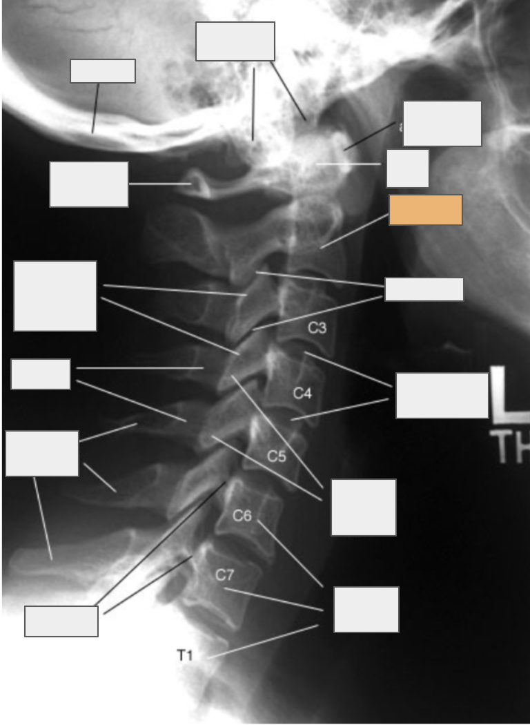 <p>What structure of the spine does the box highlighted in orange reference to?</p>