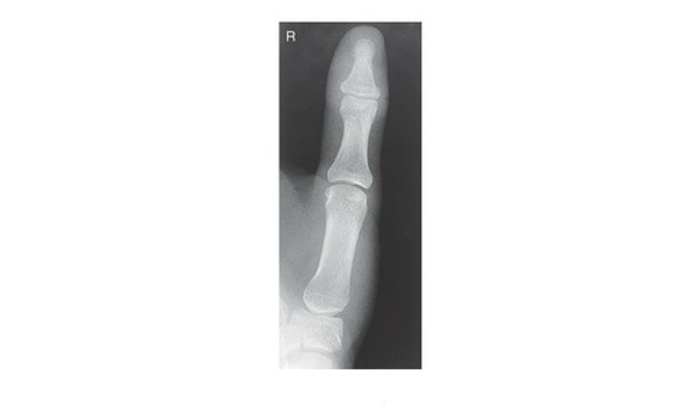 <p>a. AP</p>