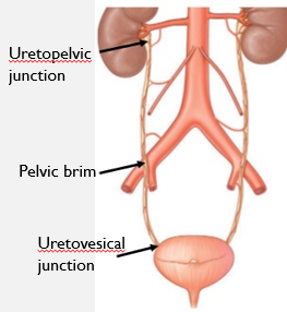 <ul><li><p>Long slender tubes of smooth muscle</p></li><li><p>Pushes urine through peristaltic waves</p></li><li><p>Diameter is ~3mm</p></li><li><p>Starts from L2 of renal pelvis and descends to bladder</p></li><li><p>Passes anterior to iliac arteries</p></li><li><p>3 constriction areas (kidney stones here are dangerous)</p><ul><li><p>Uretopelvic junction - Near hilus</p></li><li><p>Pelvic Brim - Crossing iliac vessel</p></li><li><p>Uretovesical junction - Near bladder</p></li></ul></li></ul><p></p>