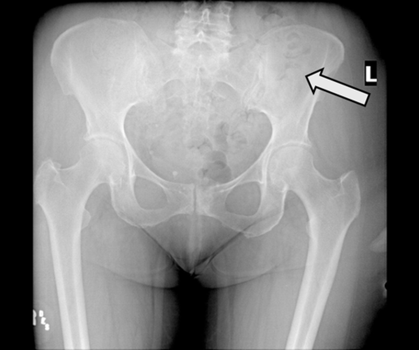 <p>What is indicated in the image?</p>