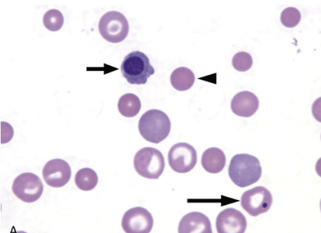 <p>what type of RBC abnormality is this</p>