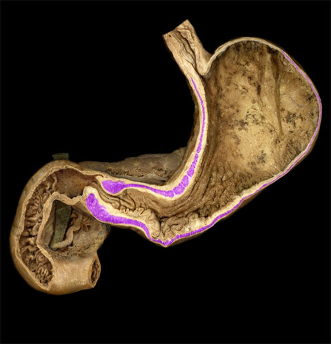 knowt flashcard image