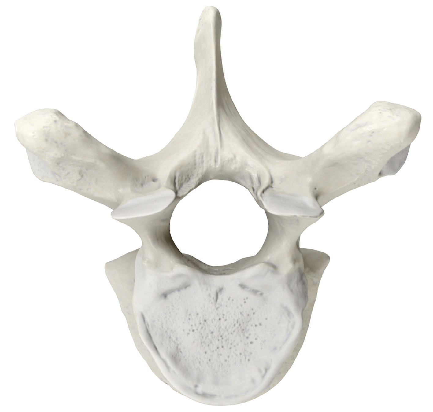 <p>The 3 basic parts of a vertebrae</p>