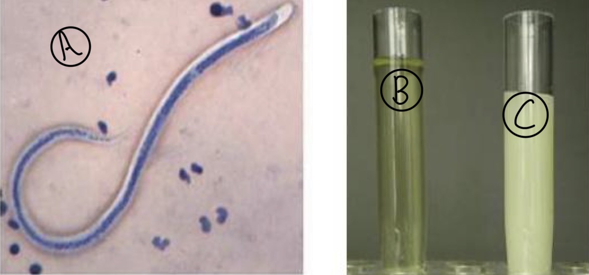 <p>A- what is the method of examination used here</p><p>B-how to use it</p><p>C- What is the name of organism in (A)</p><p>D- what is the difference between (B) and (C)</p><p>E- what is the name of the stain</p>