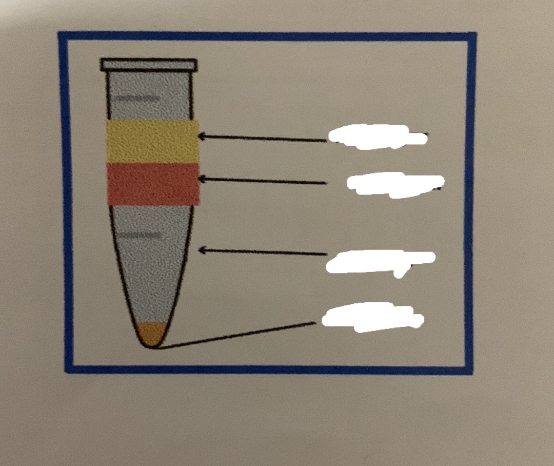 <p>Identify layers and What technique</p>