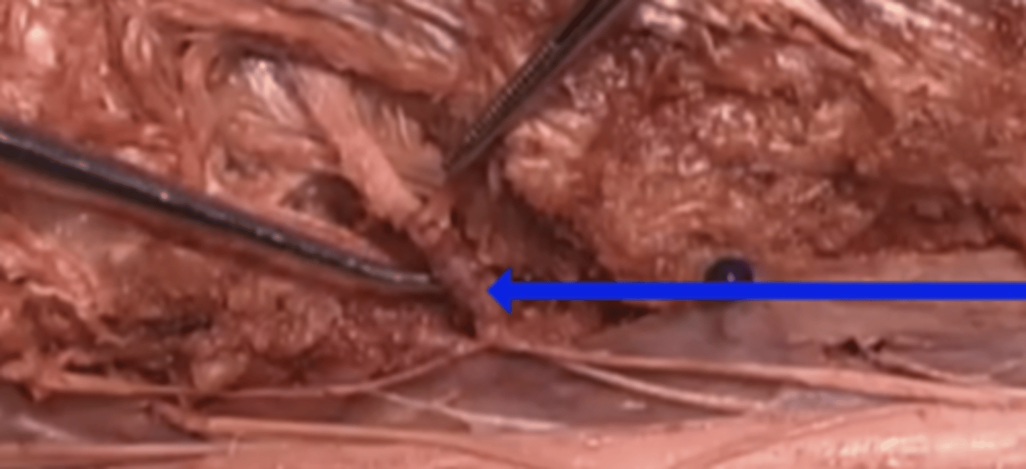 <p>What does this region represent?</p><p>pia mater</p><p>posterior root ganglion</p><p>dorsal root ganglion</p><p>dura mater</p>