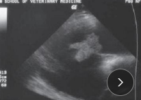<ul><li><p>More common the myocarditis</p></li><li><p><span style="color: green"><strong>MOA:</strong></span> <strong><u>tricuspid valve</u> </strong><u>of </u><strong><u>Dairy Cattle</u> </strong>than any other species</p><ul><li><p><u>bacti</u> infection</p></li></ul></li><li><p><span style="color: green"><strong>CS:</strong></span> <strong><u>intermittent fever</u></strong>, tachycardia, <strong><u>systolic heart murmur for a long time,</u></strong> <strong>pounding heart sounds</strong></p></li><li><p><span style="color: green"><strong>ID</strong></span>: <strong>Anemia(non-regen)</strong>, Neutrophilia(mature), <strong><u>High Gb + fibrinogen</u></strong>, US, Bld culture</p></li><li><p><span style="color: green"><strong>TX:</strong></span> <strong><u>&gt;3w of ceftiofur</u> </strong><u>(antibiotics)</u>, Furosemide, NSAIDs</p><ul><li><p><u>Guarded </u>to poor prognosis</p><ul><li><p>w/ ventral edema, right heart failure</p></li></ul></li></ul></li></ul><p></p>