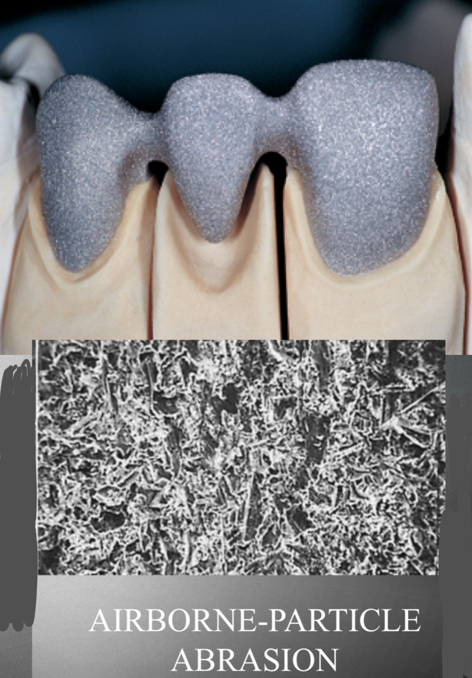 <p>Partially remove with either acid or airborne particle abrasion- gives satin finish </p>