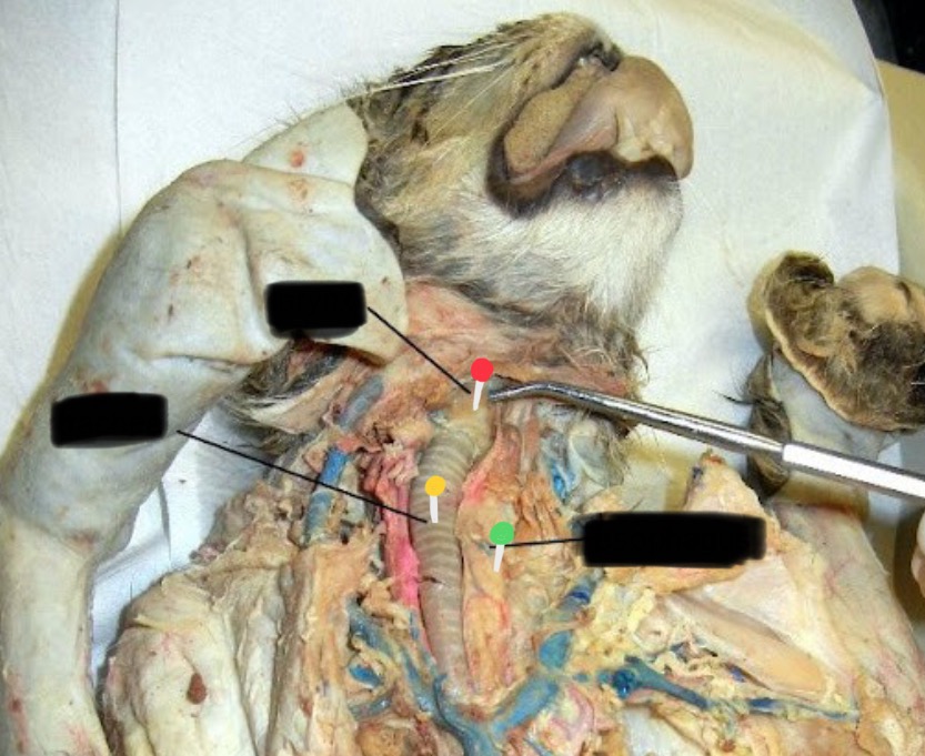 <p>What’s the yellow pin </p>