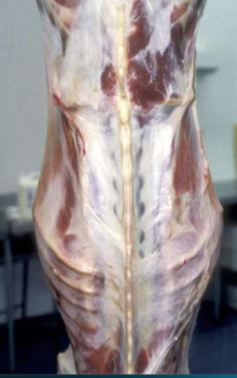 <ol><li><p><strong>Describe in 3 words</strong></p></li><li><p><strong>Potential diagnosis- </strong>emaciation (vestigial fat is gelatinous)</p><ol><li><p>Wasted carcass due to disease process often associated with edema of carcass</p></li><li><p>If carcass still shows edema several days post hanging= johne’s disease</p></li></ol></li><li><p><strong>Judgement- </strong>total rejection- category 2</p></li></ol><p></p>