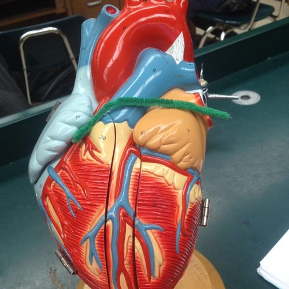 <p>on top of the heart; where great vessels located</p>