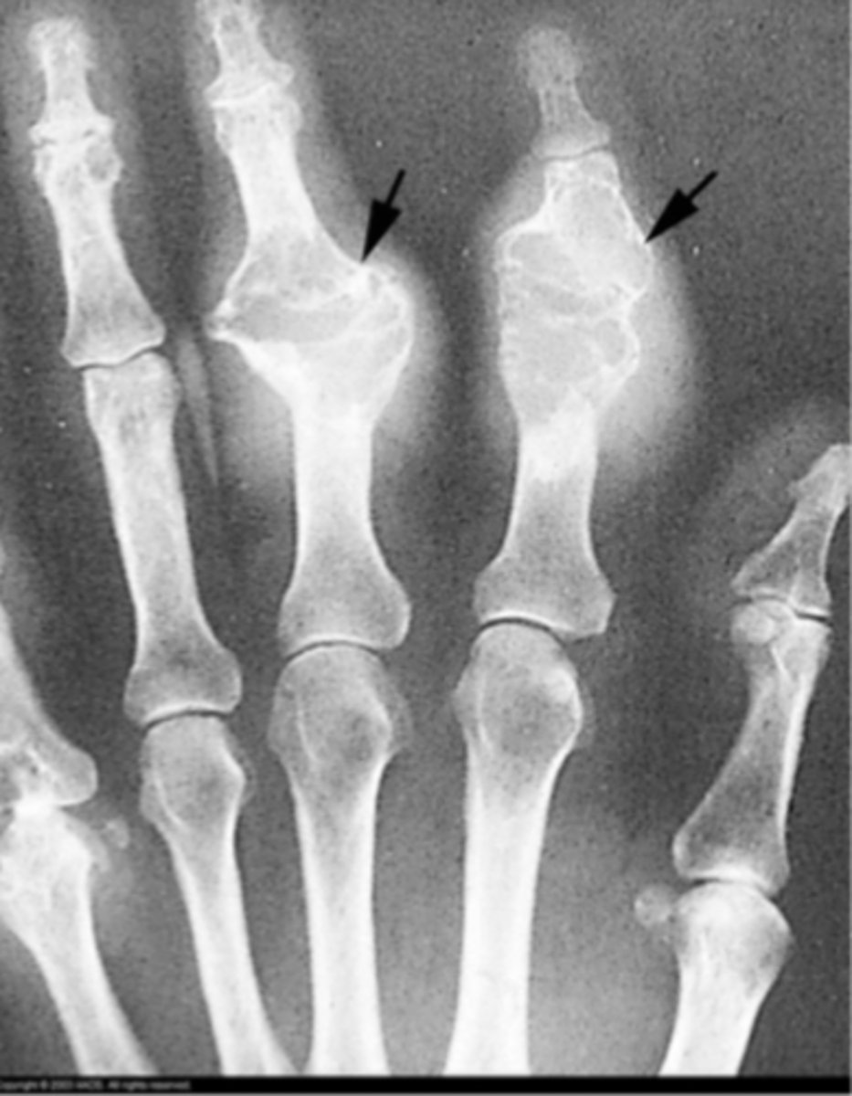 <p>What is the issue?</p>