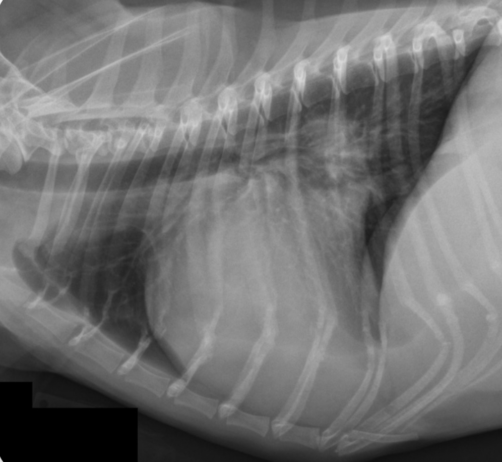 <p>What part of the heart is enlarged?</p>