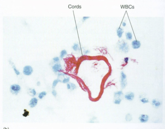<p>sample digestion, decontamination. sputum sample: mucous & bacteria can contaminate culture. culture: slow growing, aerobic, increased CO<sub>2</sub>, 35-37C. AFB stain: serpentine cording. cord inhibits phagocytosis, inhibits neutrophil migration, toxic to mammalian cells. niacin accumulation, nitrate reduction, catalase positive</p>