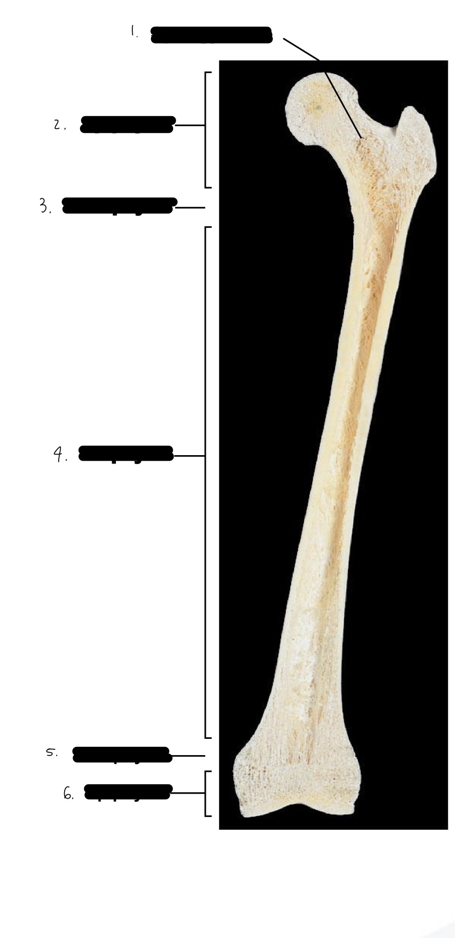 <p>label long bone</p>