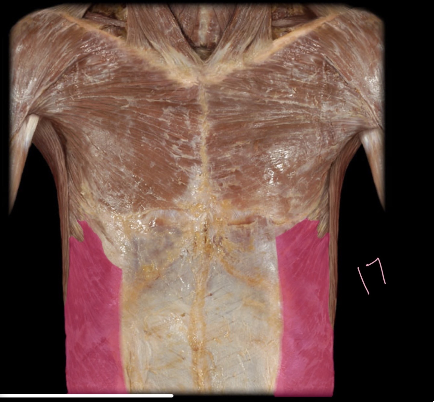 <p>External abdominal oblique m</p>