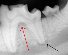 <p>What are the red and black arrows pointing to on the tooth?</p>