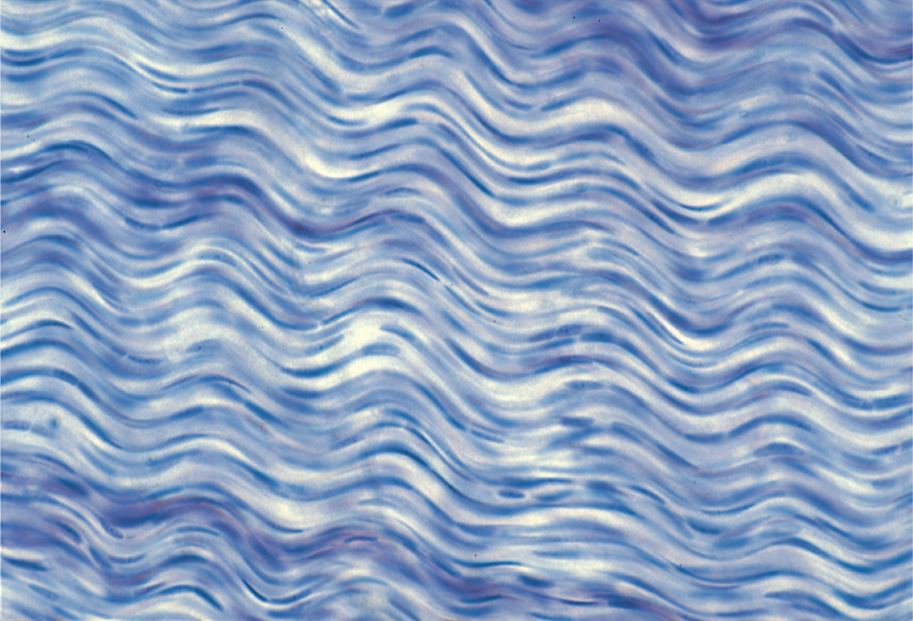 <p>Densely packed parallel collagen fibers; compressed fibroblast nuclei; elastic tissue forms waves; forms joints, tendons, and ligaments</p>