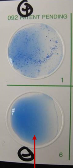 <p>staphyloslide test</p>