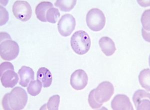 early trophozoite plasmodium malariae