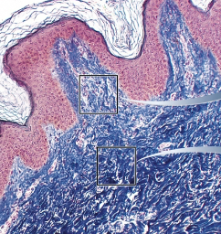 <p>Dermis</p>