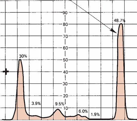 <p>What disease/ disorder is associated?</p>