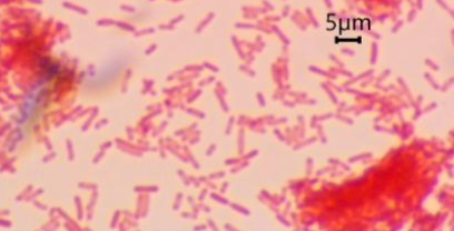 <p>&nbsp;Gram negative</p>