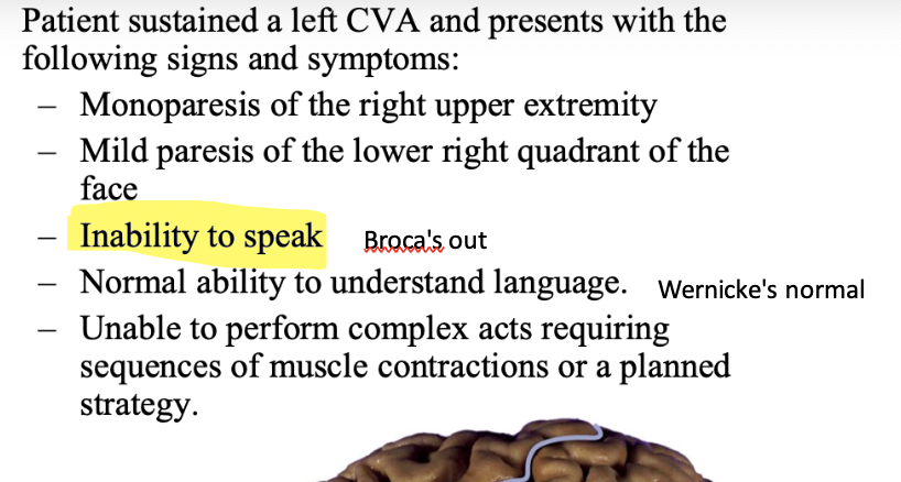 <p>what artery out?</p>